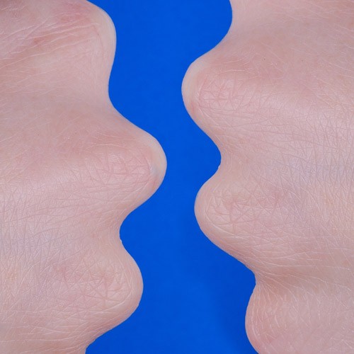 arch-hel